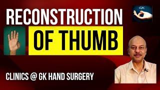 Clinics @ GK Hand Surgery: Discussion on 'Reconstruction of thumb' - Evaluation & plan of management