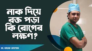 নাক দিয়ে রক্ত পড়া কি রোগের লক্ষণ?  Nose Bleeds