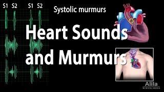 Heart Sounds and Heart Murmurs, Animation.