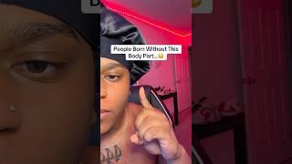 People Born Without This Body Part… #shorts