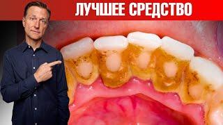 Зубной налет и зубной камень? Лучшее средство! Сделайте сами