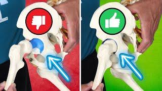 How to STOP HIP PAIN Fast! All You Need to Know