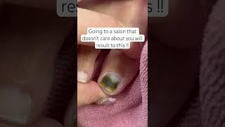 What would you do? #greenie #nails #nailtech #fypp #explore #reels