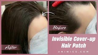 INVISIBLE Cover-up Hair Patches! PERFECT for hair-loss women!