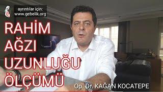 RAHİM AĞZI UZUNLUĞU ÖLÇÜMÜ NASIL YAPILIR? KAÇ MİLİMETRE OLMALI? KISALMASI ERKEN DOĞUM NEDENİ MİDİR?