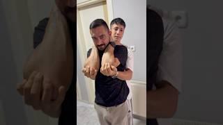 Five Eclipse Treatments Got Worse #fun #funny #my uncle #dad