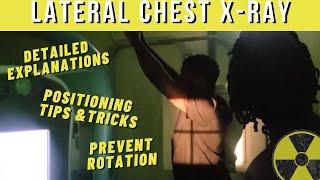 How get a TRUE Lateral Chest X-ray (Prevent rotation) || Ask The Rad Tech