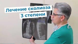 Лечение идиопатического сколиоза 3 степени | Отзыв пациента