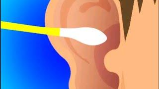 Earwax Clinic/earwax clinic offline/earwax clinic max level