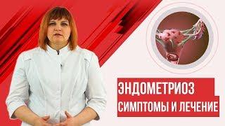 Эндометриоз. Симптомы, лечение. 3D