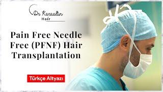 Associate Prof. Dr. Tarık Umutoğlu Pain Free Needle Free (PFNF) Hair Transplantation