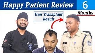 Policeman's Hair Transplant in Bhopal | Cost of Hair Transplant And Hair Transplant Doctor in Bhopal