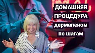 Домашняя процедура с аппаратом Дермапен. Что нужно знать. Мои впечатления и советы@SubTatiana