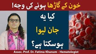 Blood Clotting Treatment In Urdu/Hindi| Blood Clot Treatment | Ragoon Mn Khoon Jamnay Ka Ilaj