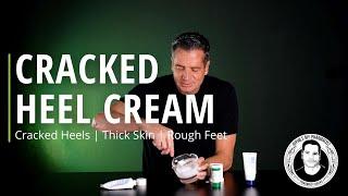 Cracked Heel Cream