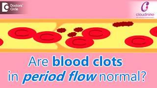 Why does menstrual bleeding have blood clots? Is it normal?-Dr.Shalini Varma of Cloudnine Hospitals