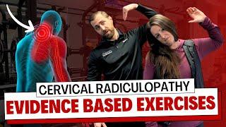 Cervical Radiculopathy Exercise Guide [Evidence-Based]