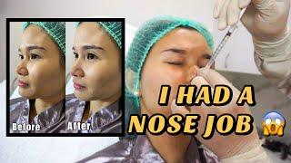 I HAD A NOSE JOB | Jen Barangan