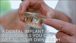 Dr. Sheehan answers your dental implant questions