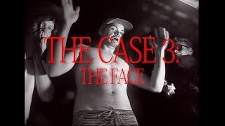 The case episode 3: "The Face"