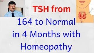 Thyroid cured by Dr. Ketan Shah | TSH 164 to Normal | Only Homeopathy |