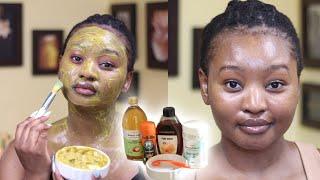 DIY TURMERIC AND BENTONITE CLAY MASK | Pimple and Dark Spots Treatment | Tsholo Phoka