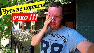 На меня жестоко напали !!! Чуть не лишился глаза !!! Что делать дальше ???