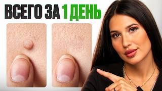 Я нашла НОВОЕ СРЕДСТВО! Как НАВСЕГДА избавиться от папиллом