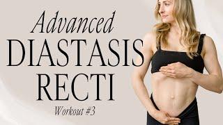 Advanced Diastasis Recti Repair Plan - Workout #3 - Lauren Fitter