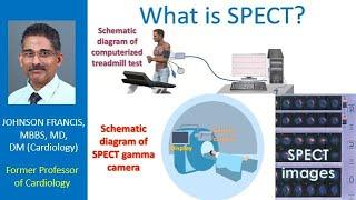 What is SPECT?