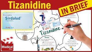 Tizanidine 4 mg (Zanaflex): What Is Tizanidine Used For? Uses, Dosage and Side Effects of Tizanidine