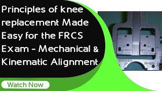 Principles of Knee Replacement Made Easy for the FRCS Exam | Mechanical & Kinematic Alignment