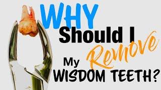 PATIENT EDUCATION - Why Should I REMOVE my WISDOM TEETH?