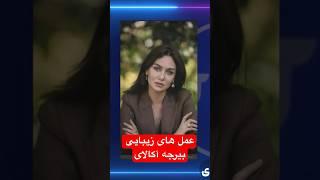 عمل های زیبایی بیرجه آکالای #shorts #turkishdrama #turkishseries #series