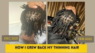 MY LOCS WERE BREAKING OFF AT THE ROOT || HOW I GREW BACK MY HAIR || TIPS FOR THINNING LOCS