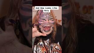 People who got plastic surgery to look like animals #shorts