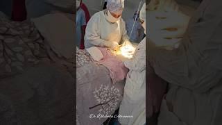 Keserva kesish amaliyoti. +998936544330Dr.Dilshoda Akramova