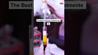 Best Hair Loss Treatment That Actually Works | PRP Therapy for Hair Loss | HairMD Clinic, Mumbai