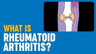 What is rheumatoid arthritis?