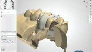 Intro to Dental CAD/CAM - Plan