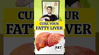 CURE Your Fatty Liver #shorts #trending #exercise