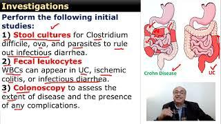 Ulcerative Colitis