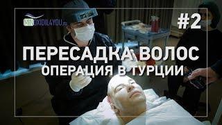 Пересадка волос на голове в Турции. Выпадение и лечение волос, миноксидил для волос. Minoxidil4you