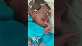 SMMH MEDICAL COLLEGE SAHARANPUR 🩺 || Small baby EEG Test || GMC Medical College Saharanpur #medical