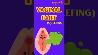 Vaginal Fart (Queefing). #fart #vagina #shorts #вагина