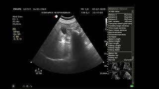 УЗИ органов брюшной полости и почек