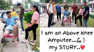 Above Knee Amputee || My story || Prosthetics || #ottobock #disability #prostheticleg #vlog #amv