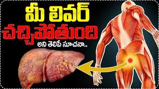 10 Symptoms of Liver Problem | liver damage Sign || Dr. Kavya Interview With Anchor Swapna | SumanTV