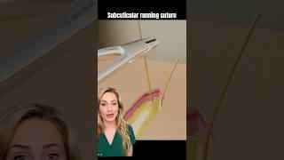 How doctors place hidden stitches