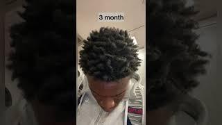 Freeform dreads journey 6 month growth #freeformlocs #shorts #dreadlocks